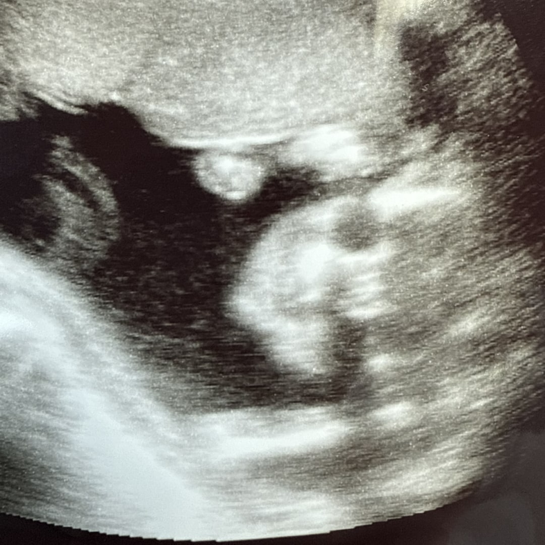 Photo shared by Kiana for their Babylist baby registry.