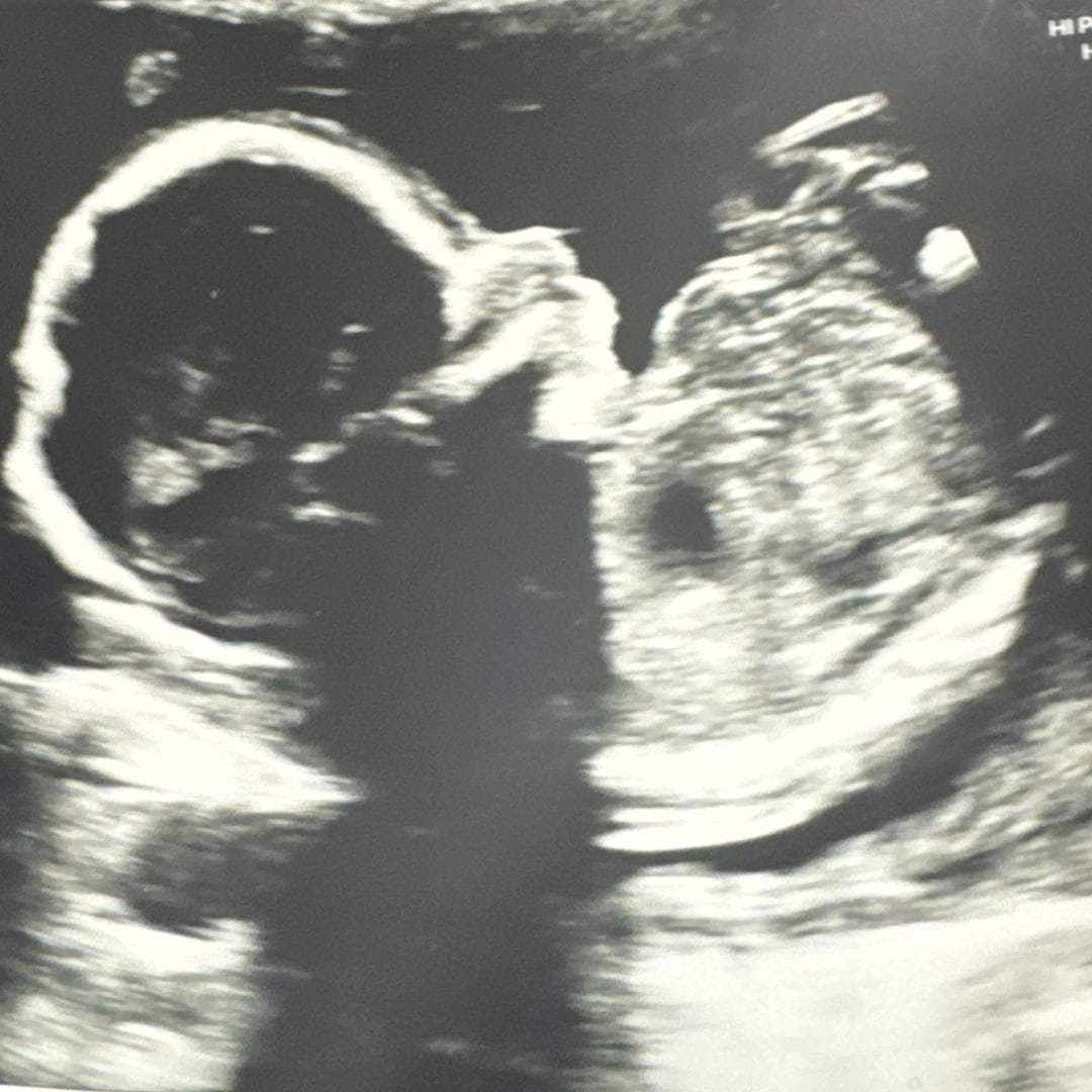 Photo shared by Allie for their Babylist baby registry.