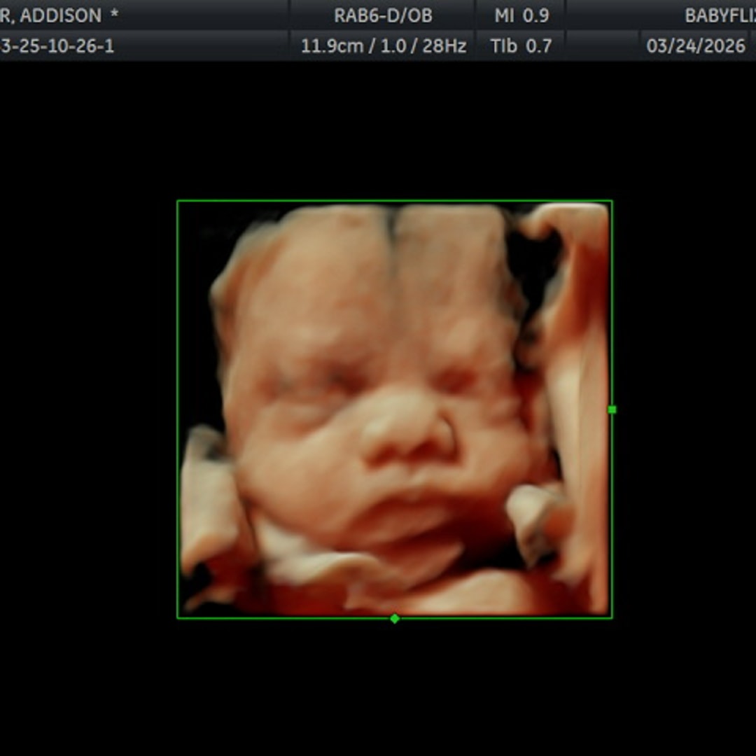 Photo shared by Addison for their Babylist baby registry.