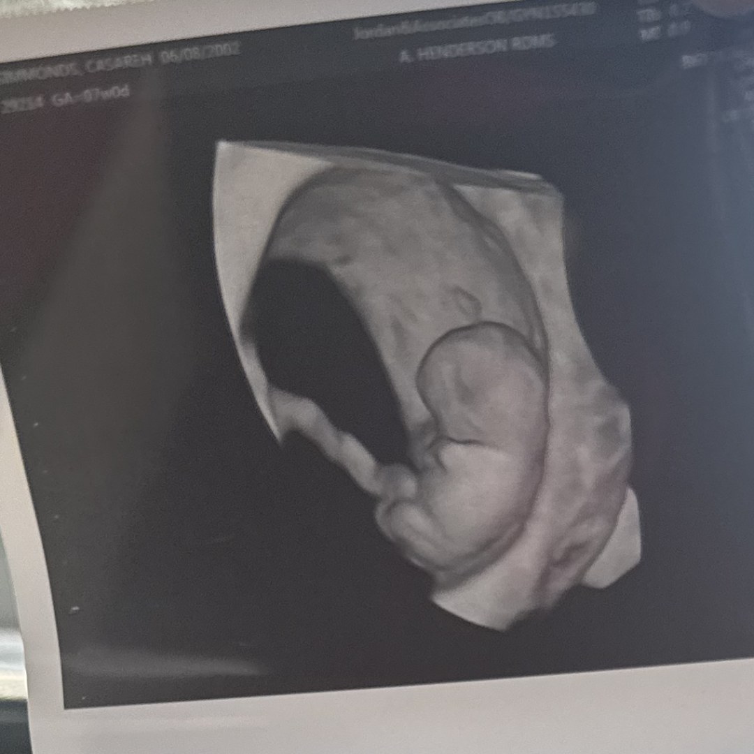 Photo shared by Caserah for their Babylist baby registry.