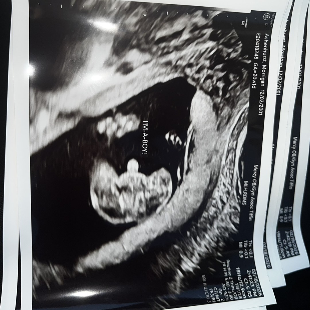 Photo shared by Morrigan for their Babylist baby registry.