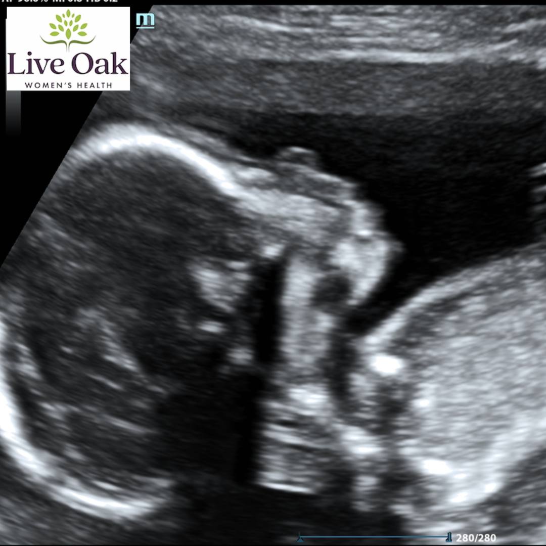 Photo shared by Natalie for their Babylist baby registry.