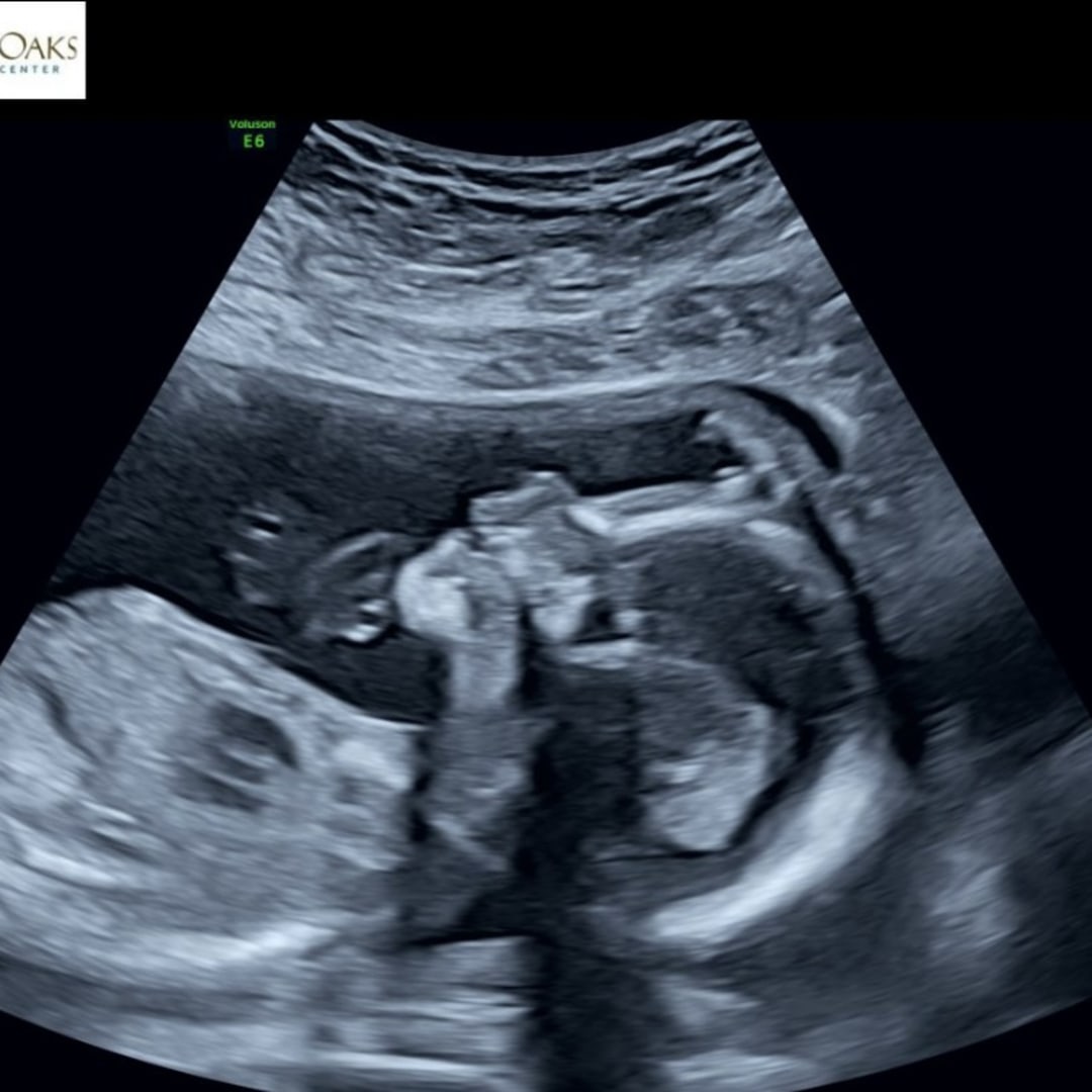 Photo shared by Heather for their Babylist baby registry.