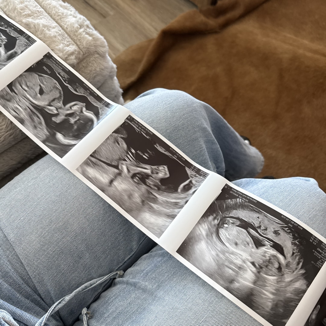 Photo shared by Chloe for their Babylist baby registry.