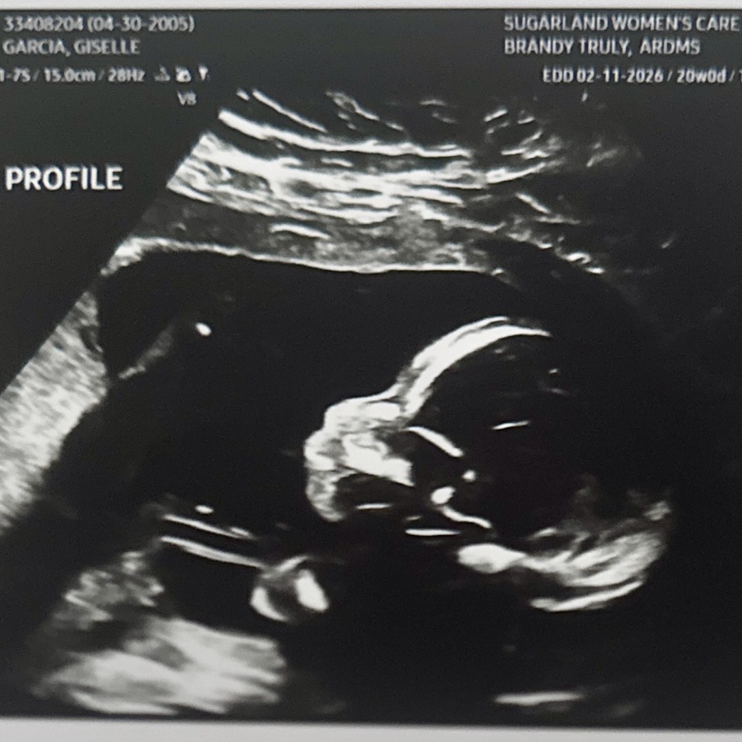 Photo shared by Giselle for their Babylist baby registry.