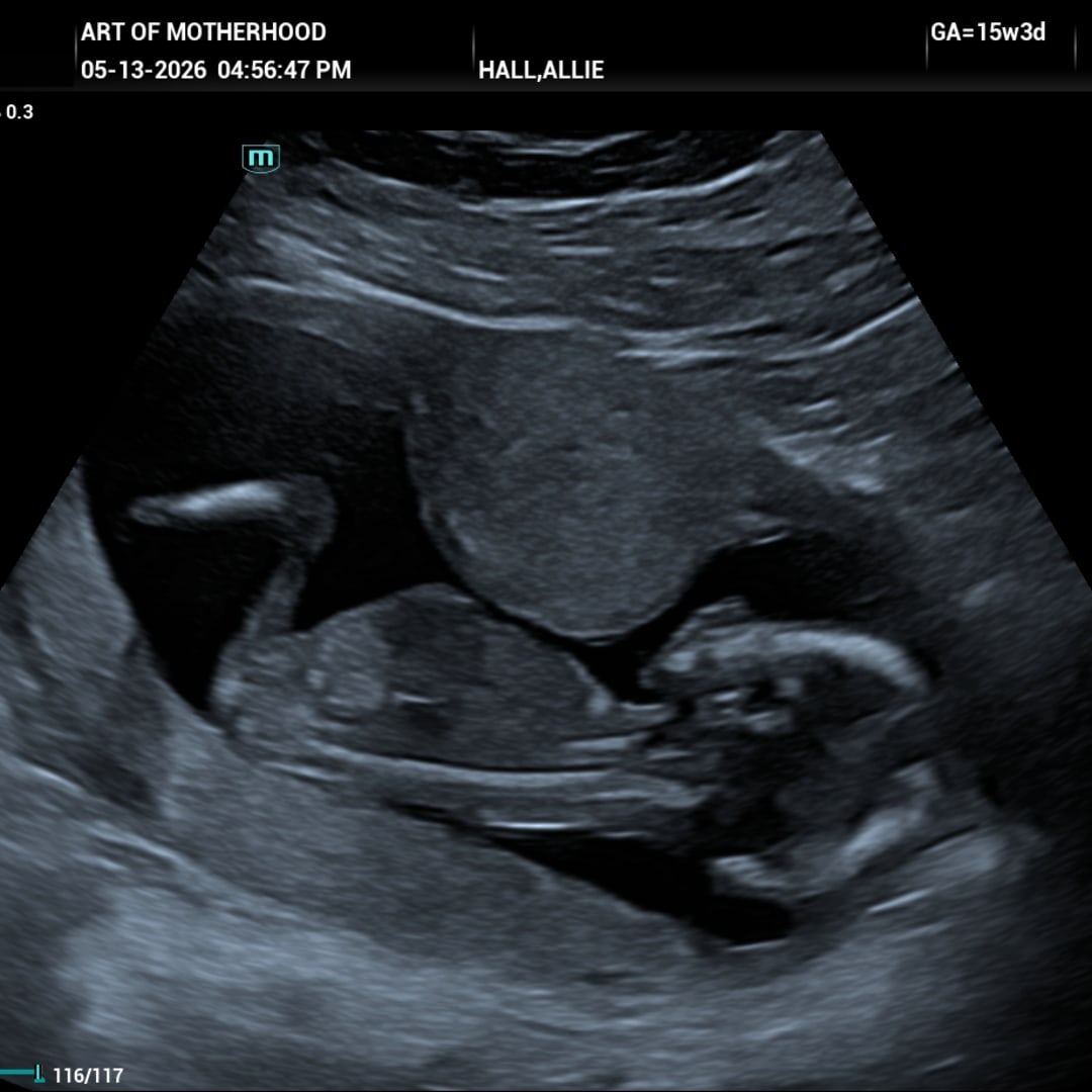 Photo shared by Allie for their Babylist baby registry.