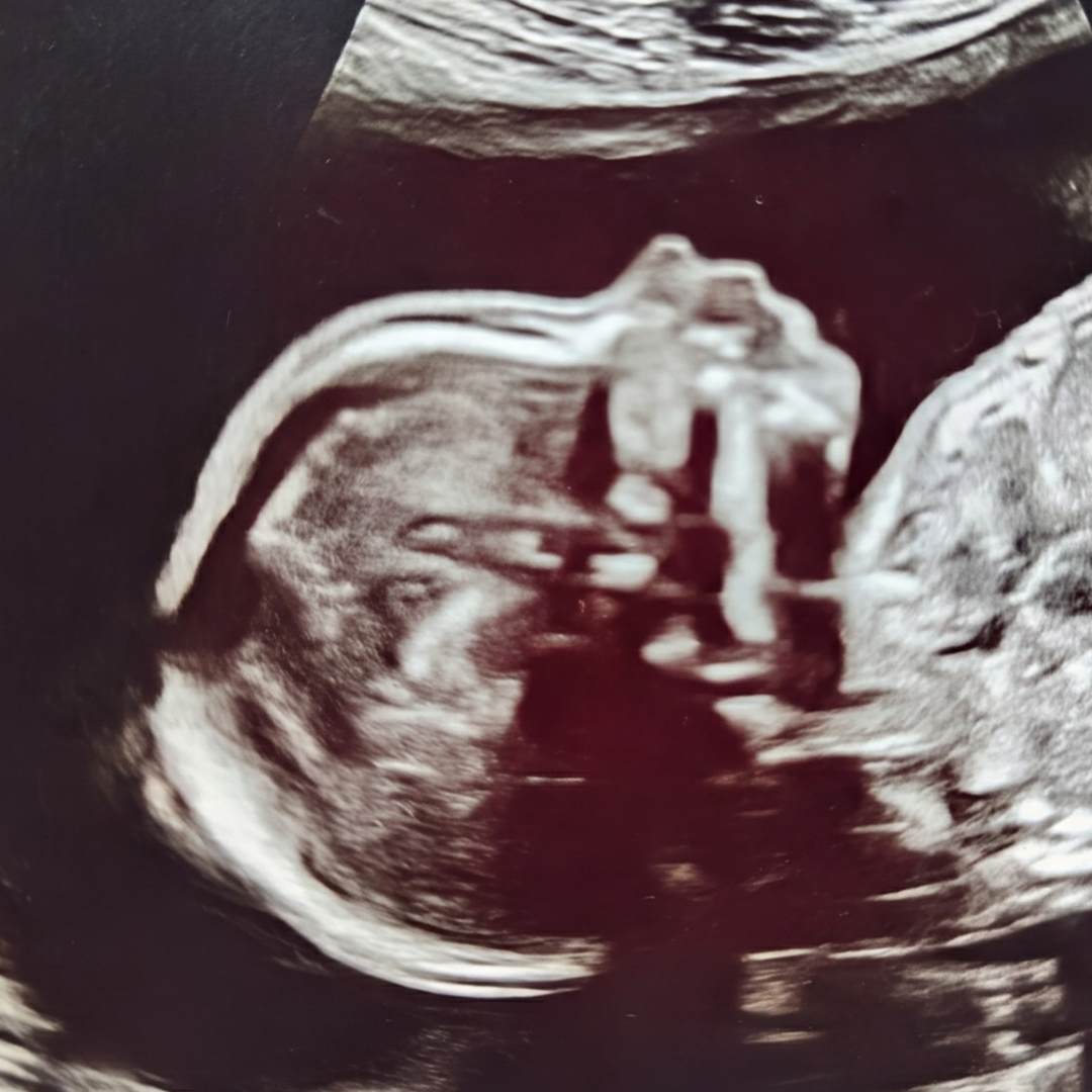 Photo shared by Lindsay for their Babylist baby registry.