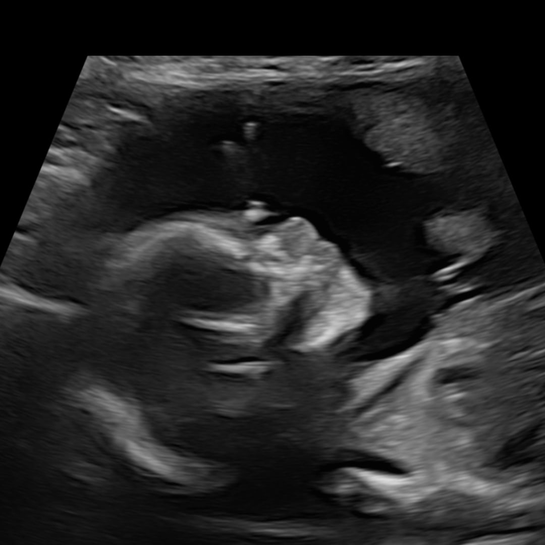 Photo shared by Sierra for their Babylist baby registry.