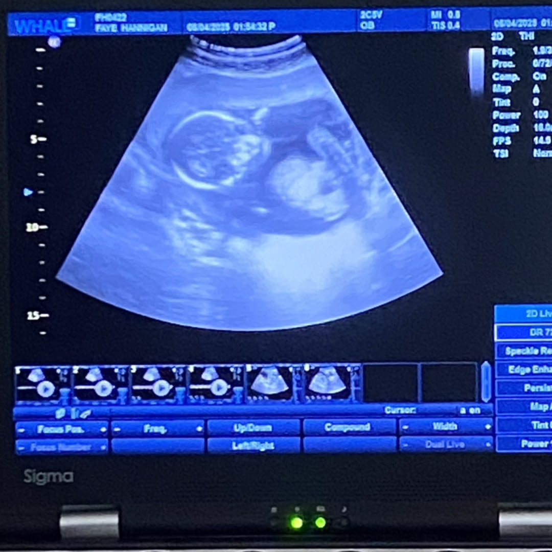 Photo shared by Faye for their Babylist baby registry.