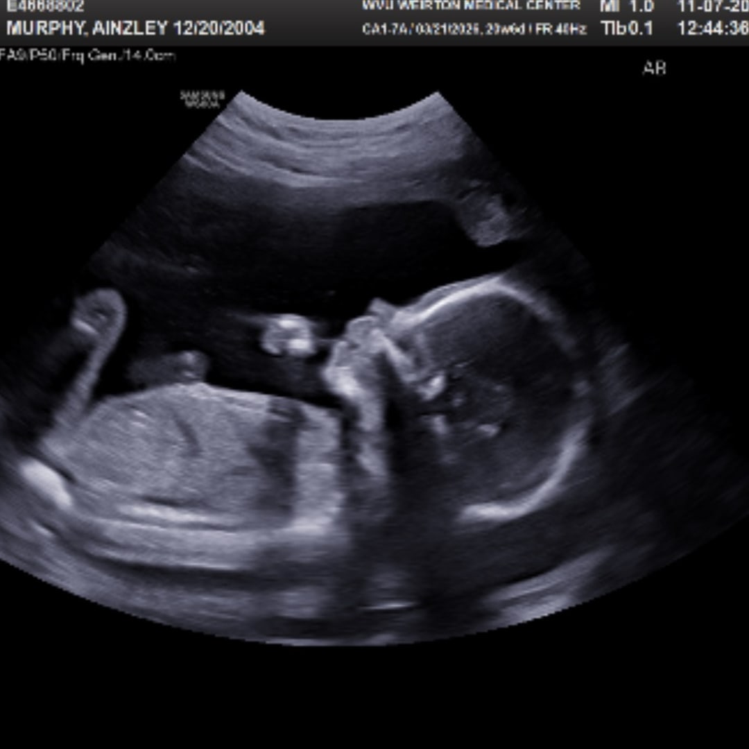 Photo shared by Ainzley for their Babylist baby registry.