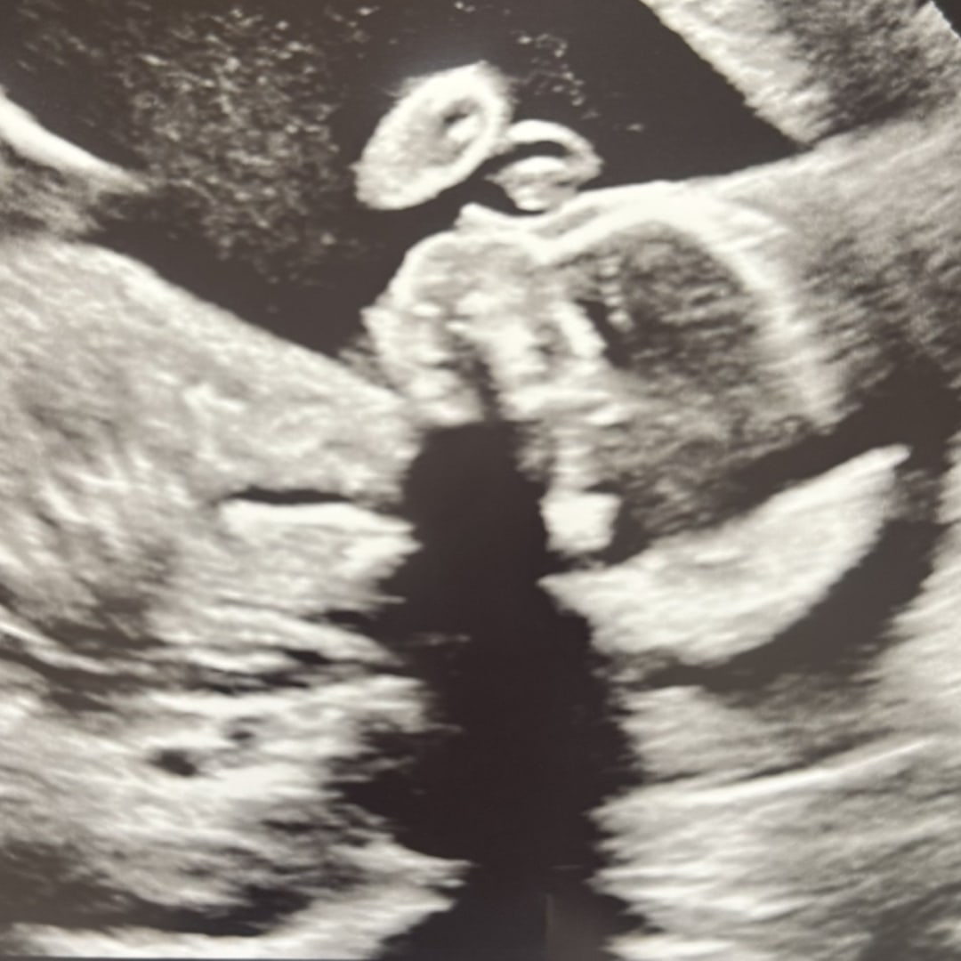 Photo shared by Alex for their Babylist baby registry.