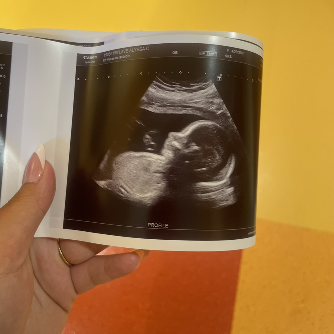 Photo shared by Alyssa for their Babylist baby registry.
