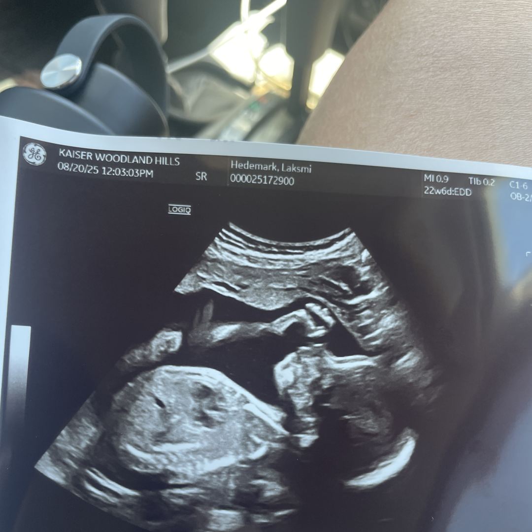 Photo shared by Laksmi for their Babylist baby registry.