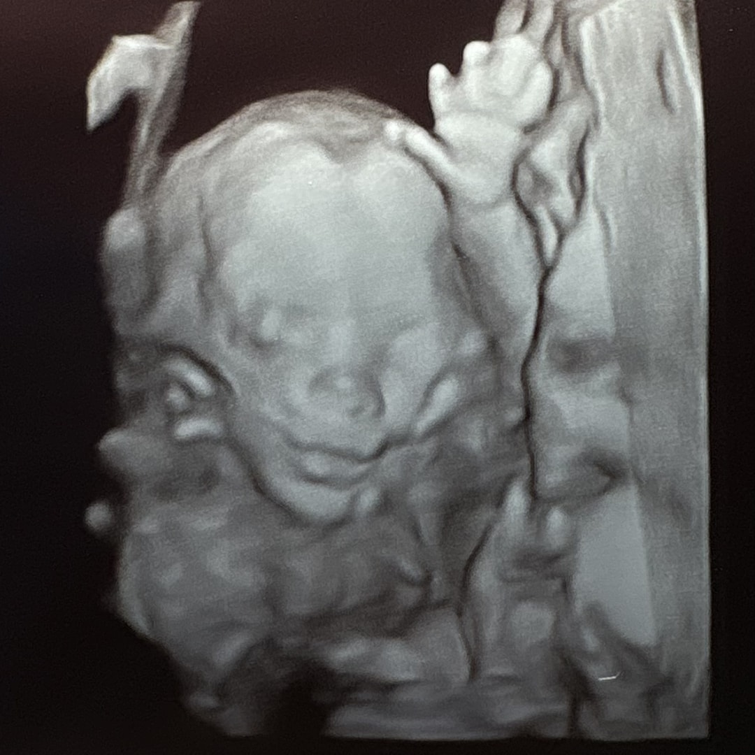 Photo shared by Margeaux for their Babylist baby registry.