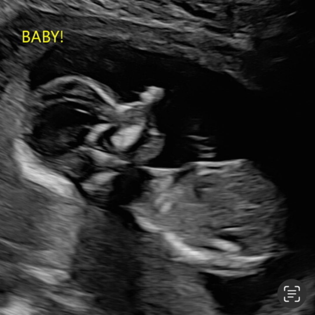 Photo shared by Ameyah for their Babylist baby registry.