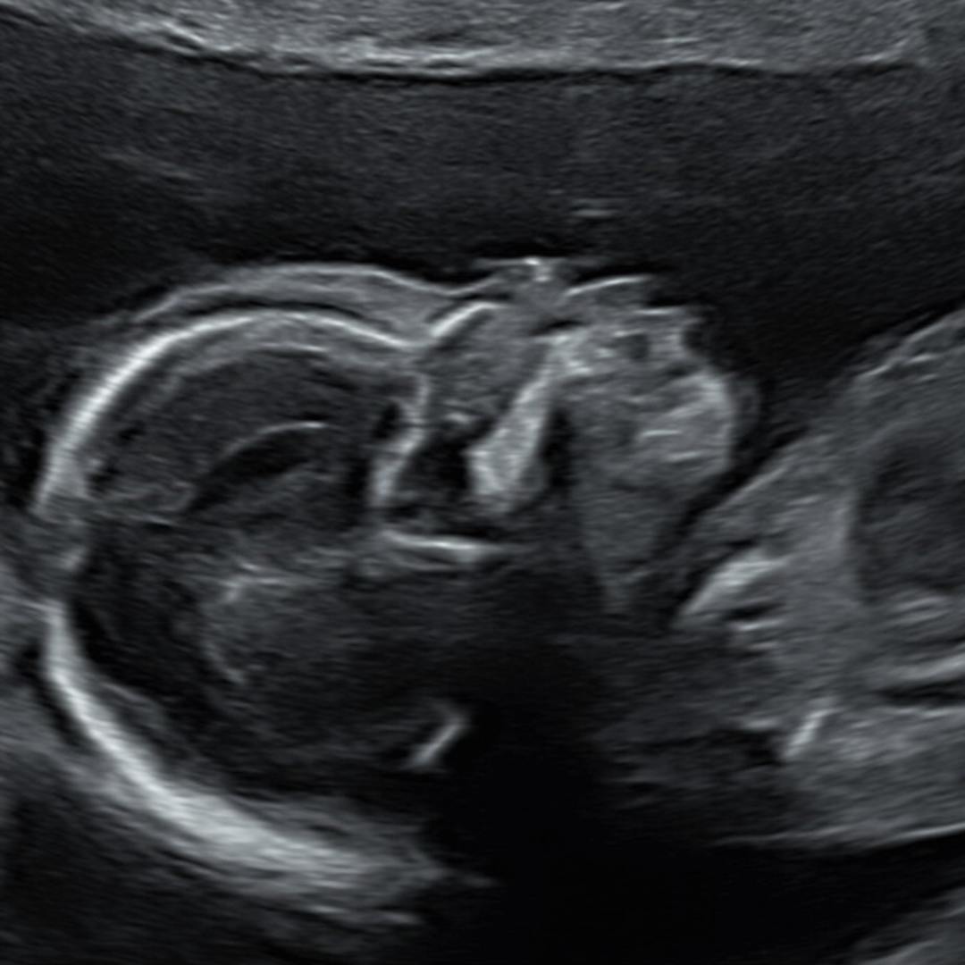 Photo shared by Lizette for their Babylist baby registry.