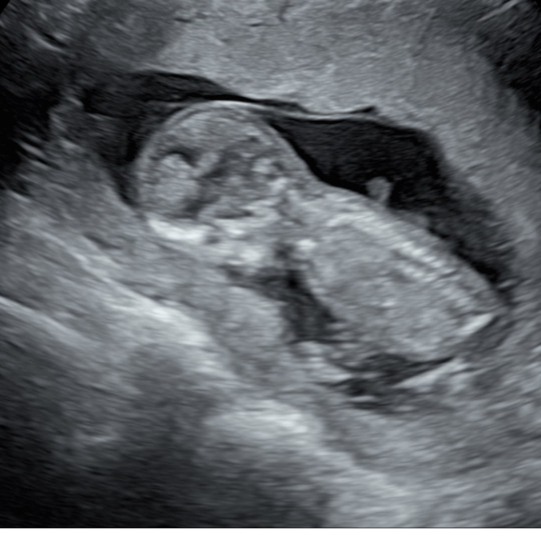 Photo shared by Sydney for their Babylist baby registry.