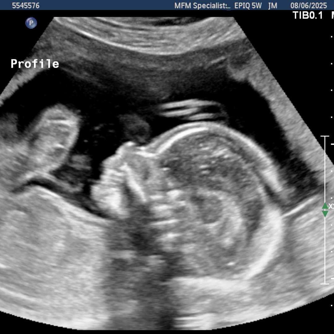 Photo shared by Lucila for their Babylist baby registry.