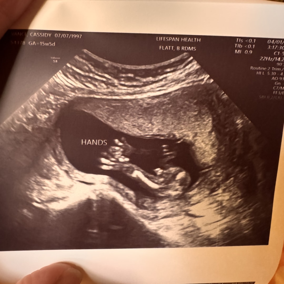 Photo shared by Cassidy for their Babylist baby registry.