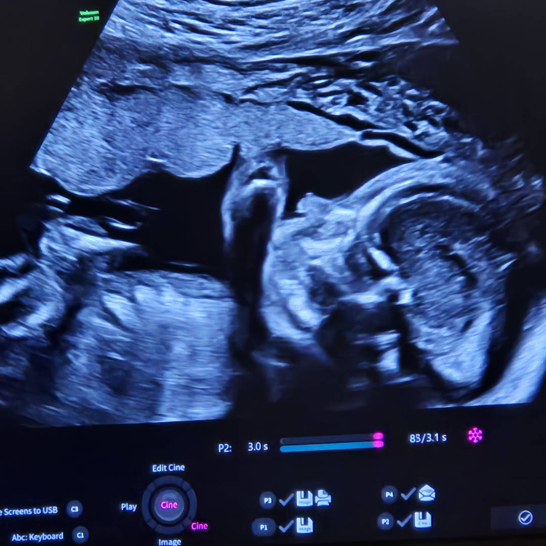Photo shared by Grace for their Babylist baby registry.