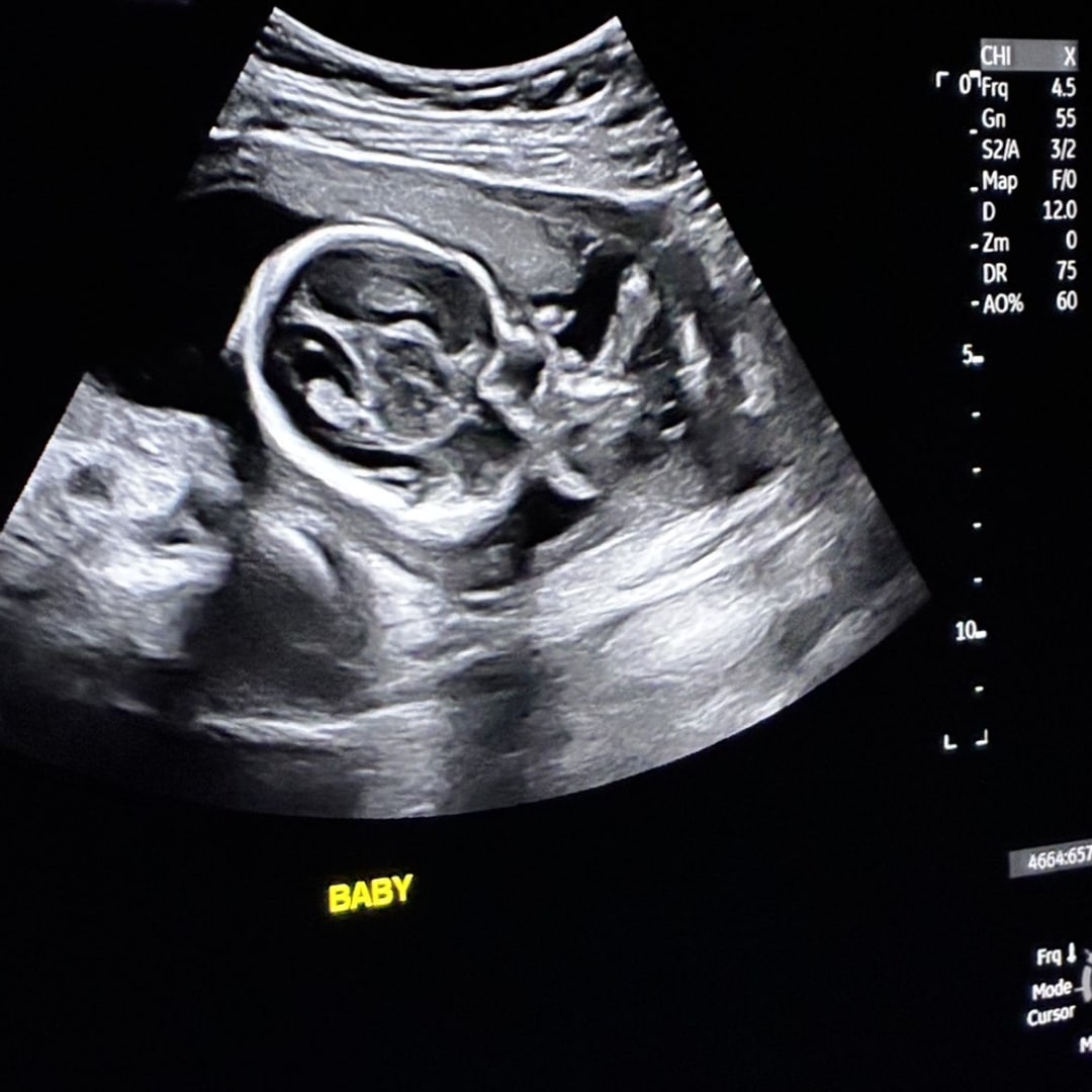 Photo shared by Harmony for their Babylist baby registry.