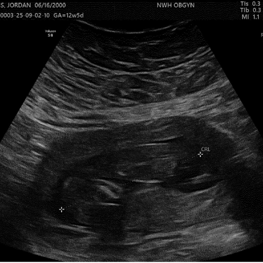 Photo shared by Jordan for their Babylist baby registry.