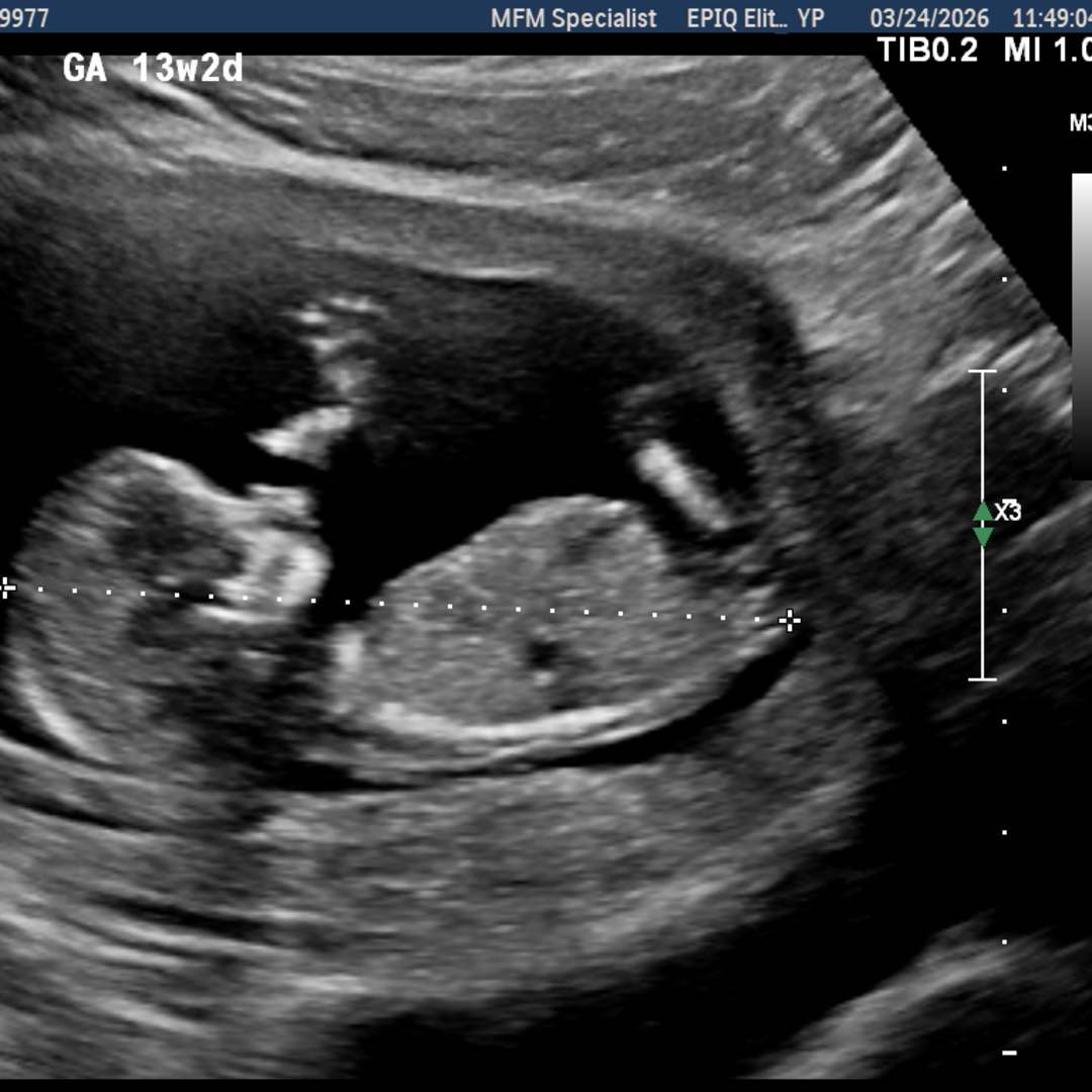 Photo shared by Darcie for their Babylist baby registry.