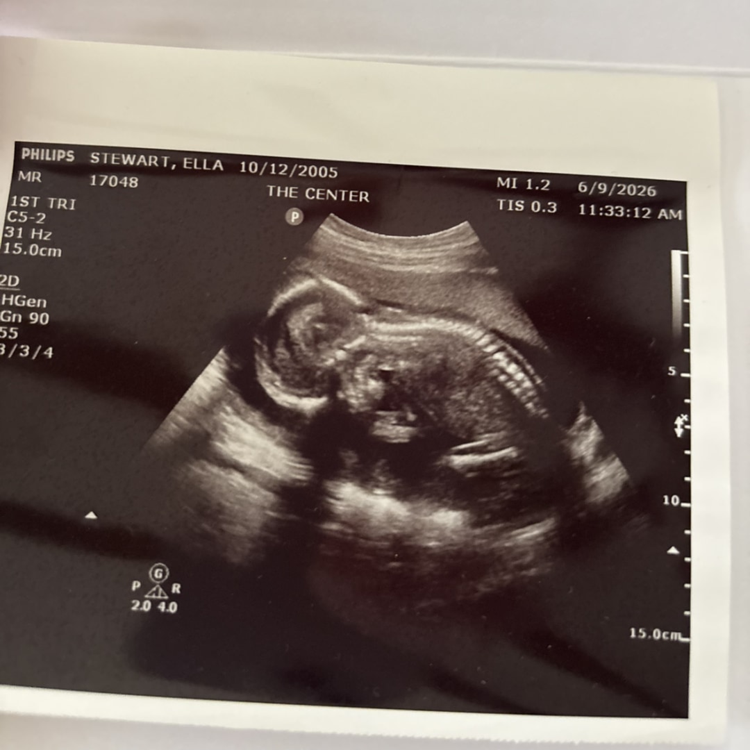 Photo shared by Ella for their Babylist baby registry.