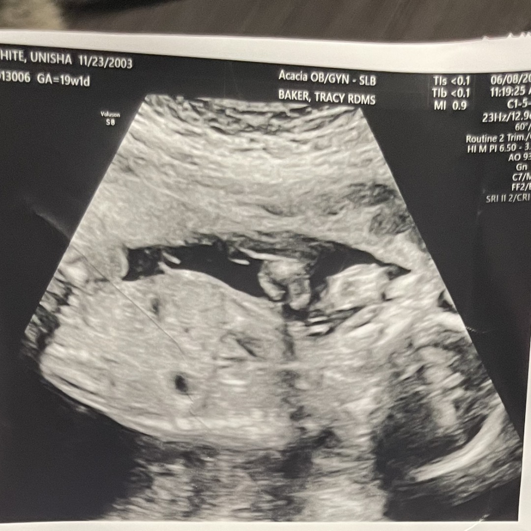 Photo shared by Nisha for their Babylist baby registry.