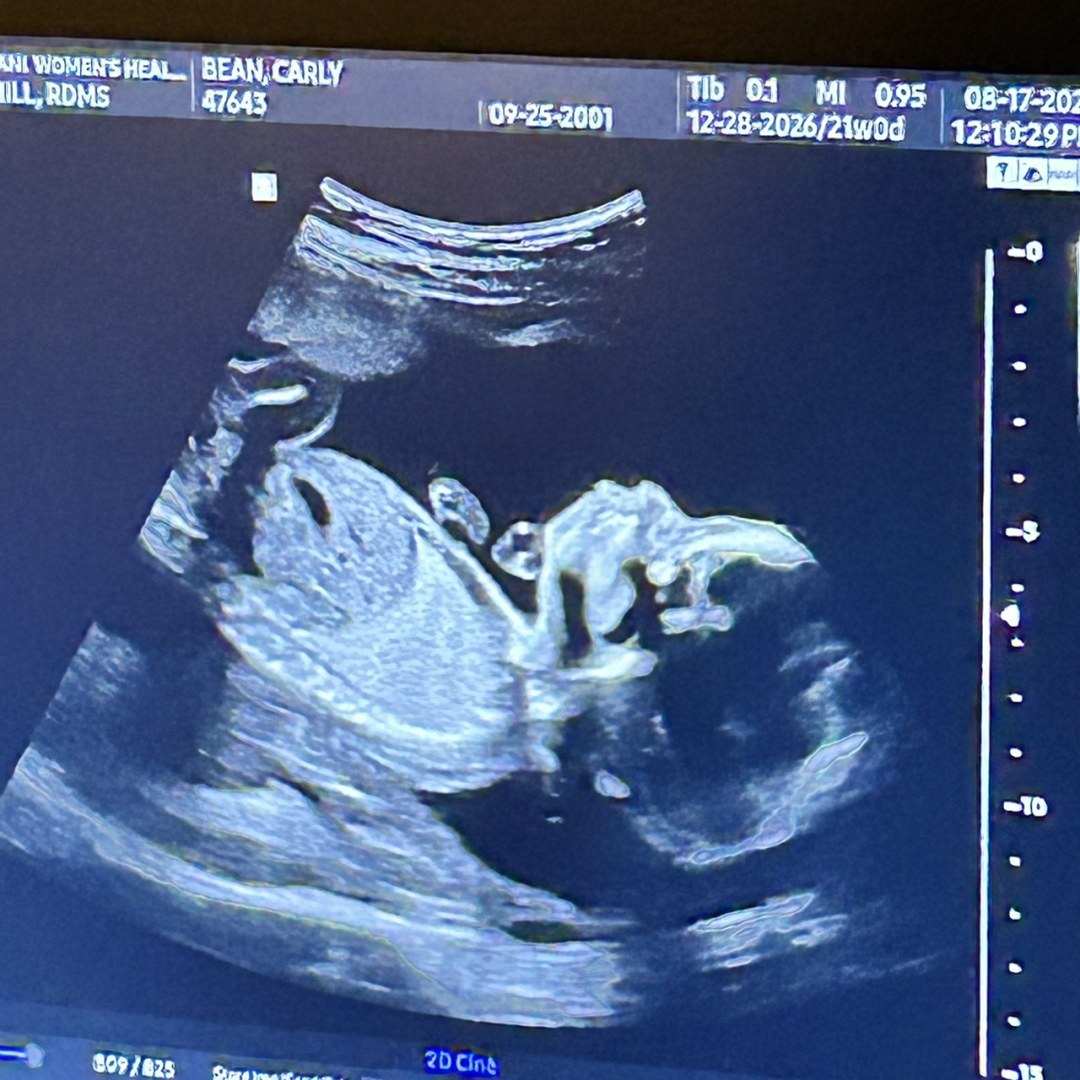 Photo shared by Carly for their Babylist baby registry.