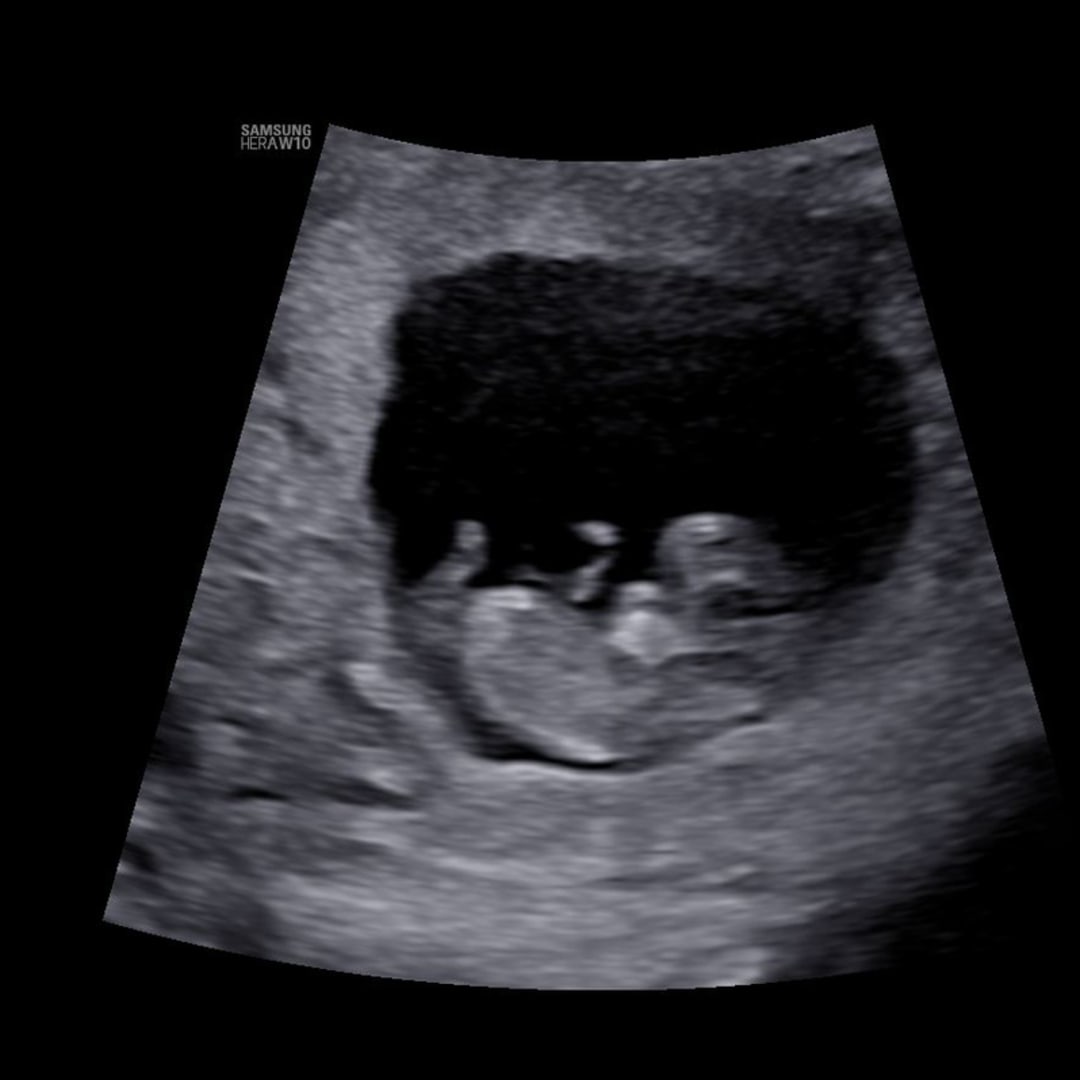 Photo shared by Sierra for their Babylist baby registry.