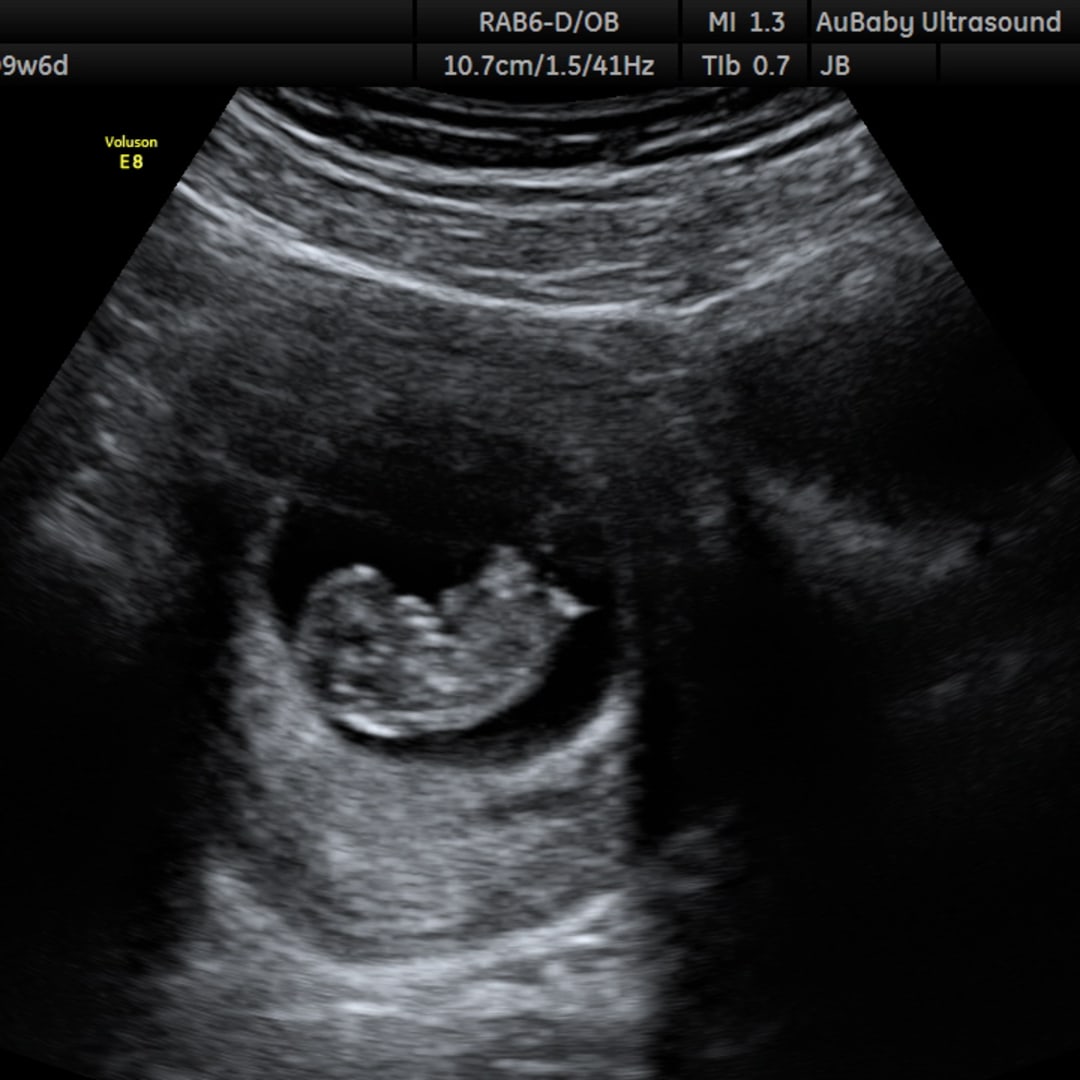 Photo shared by Kathryn for their Babylist baby registry.