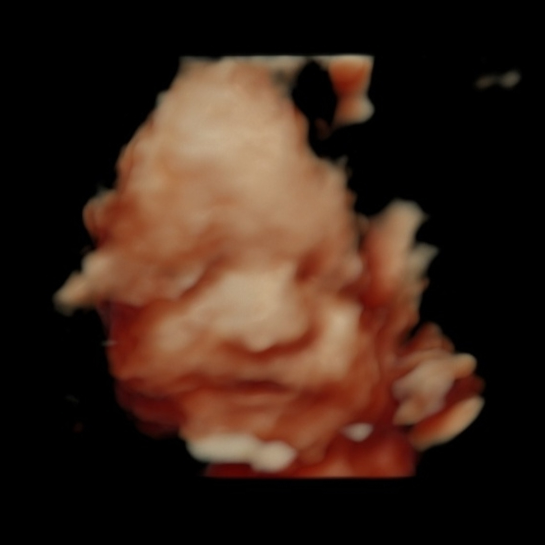 Photo shared by Candice for their Babylist baby registry.