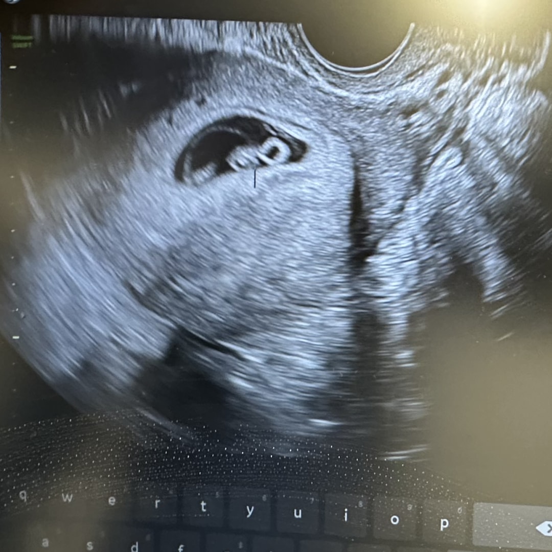 Photo shared by Charity for their Babylist baby registry.