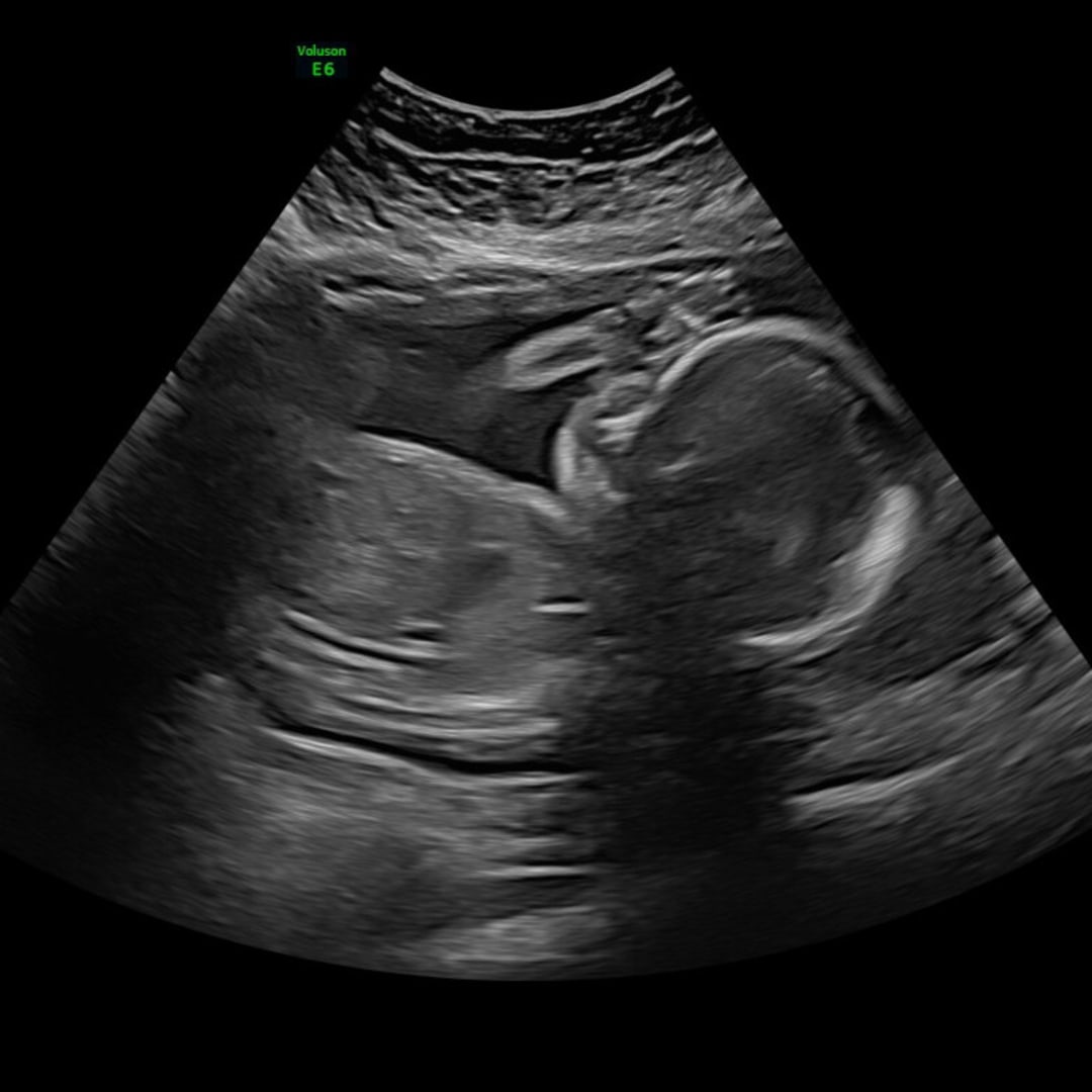 Photo shared by Lainey for their Babylist baby registry.