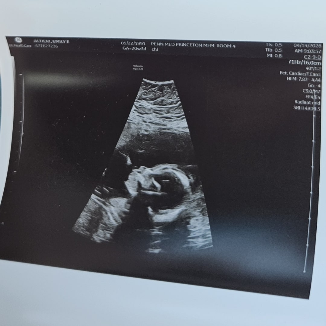 Photo shared by Emily for their Babylist baby registry.