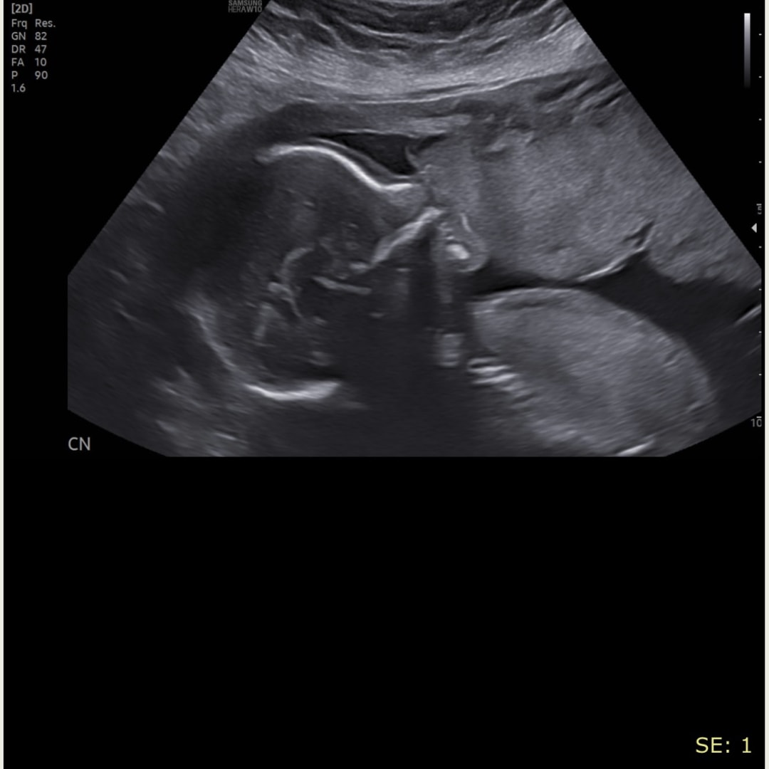 Photo shared by Valerie for their Babylist baby registry.