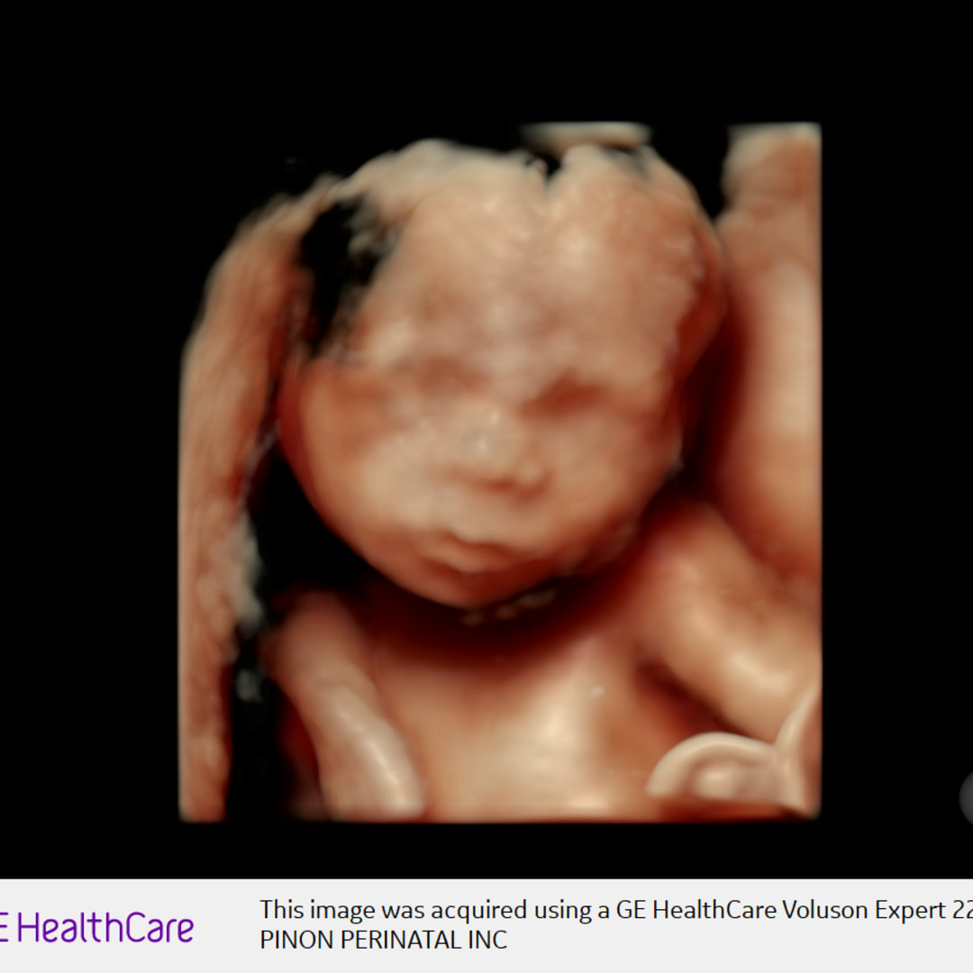 Photo shared by Cassandra for their Babylist baby registry.