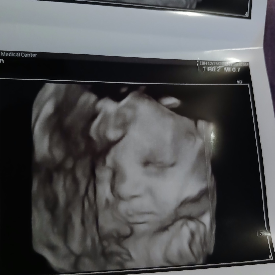 Photo shared by Kay for their Babylist baby registry.