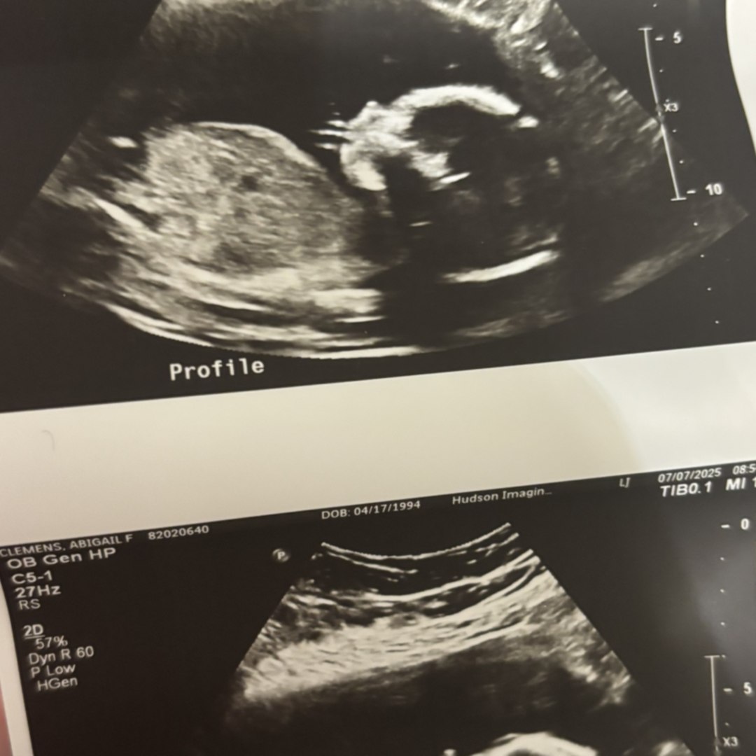 Photo shared by Abigail for their Babylist baby registry.