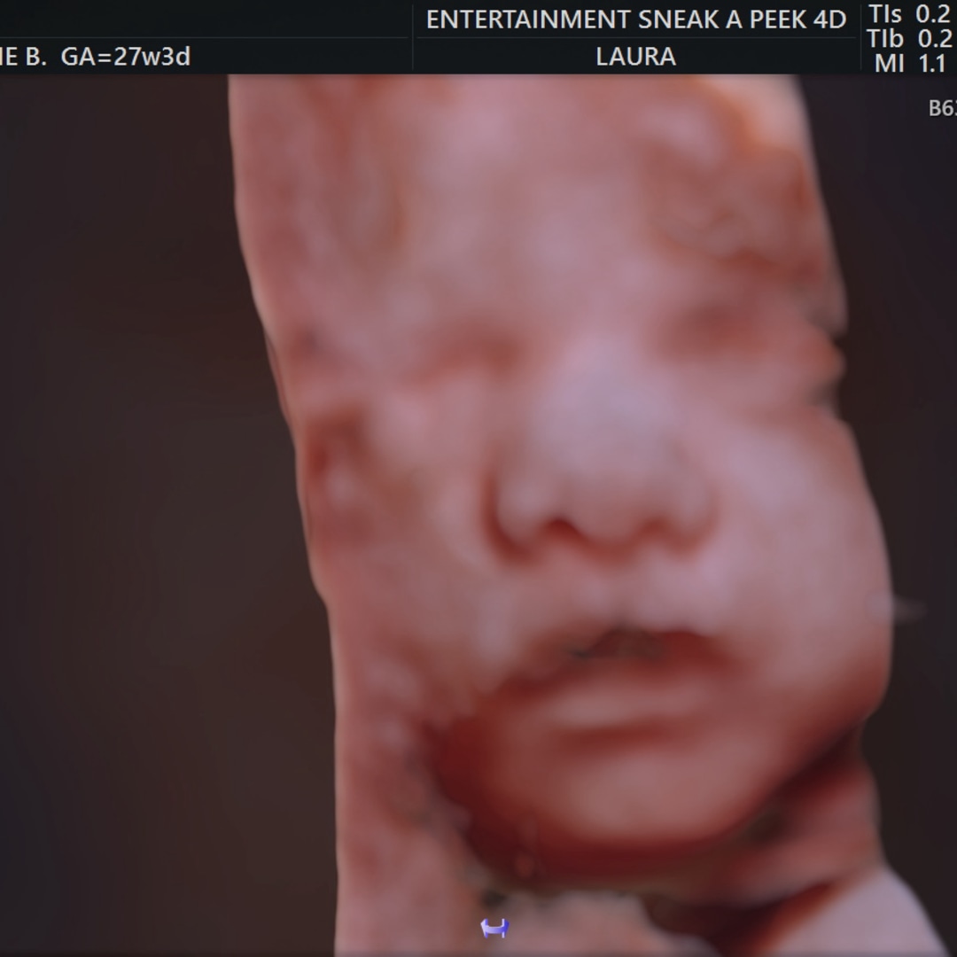 Photo shared by Kenzie for their Babylist baby registry.