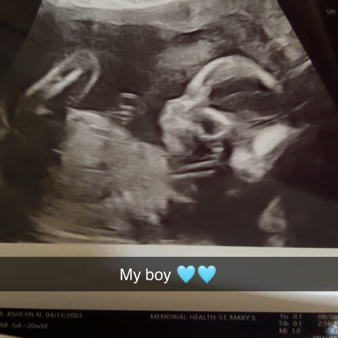 Photo shared by Ashlyn for their Babylist baby registry.