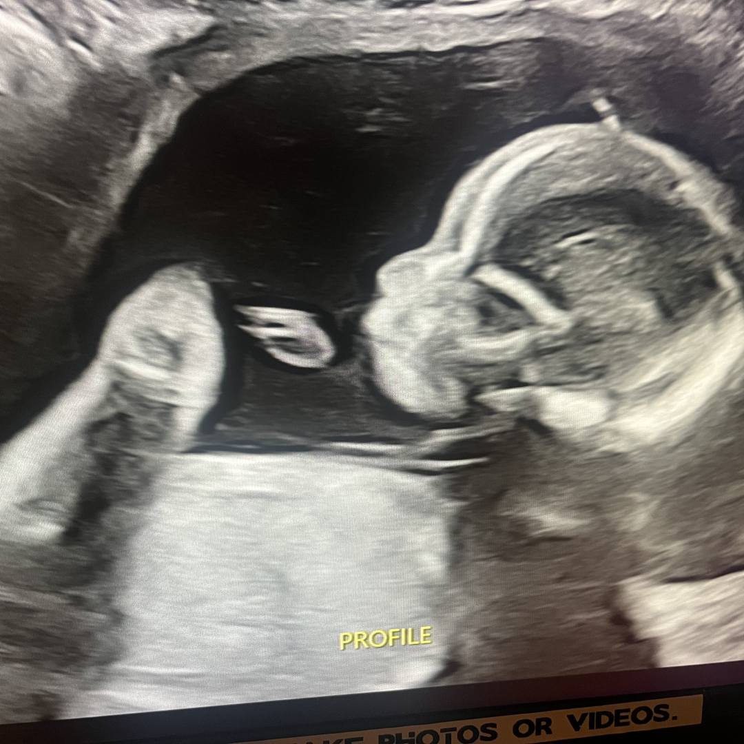 Photo shared by Samantha for their Babylist baby registry.