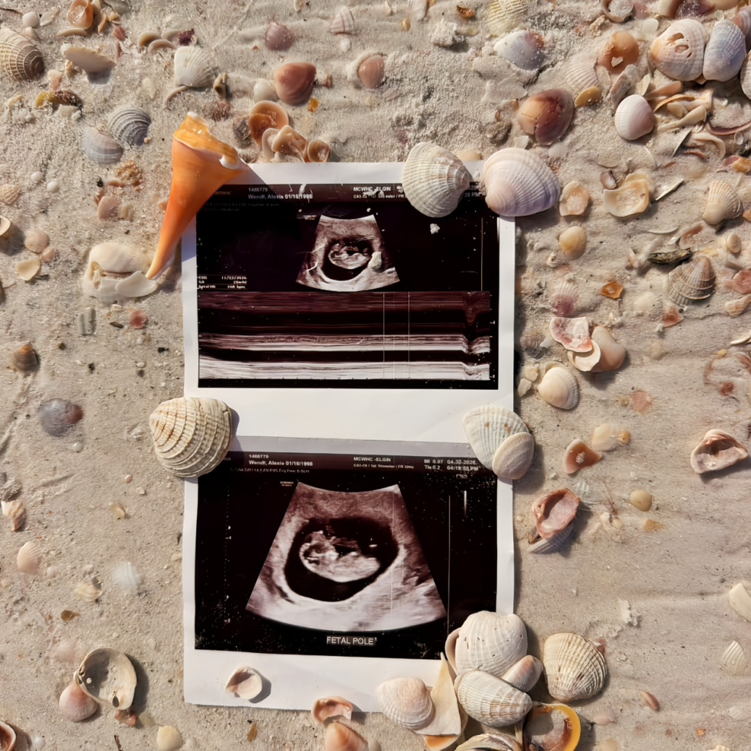 Photo shared by Alexis for their Babylist baby registry.