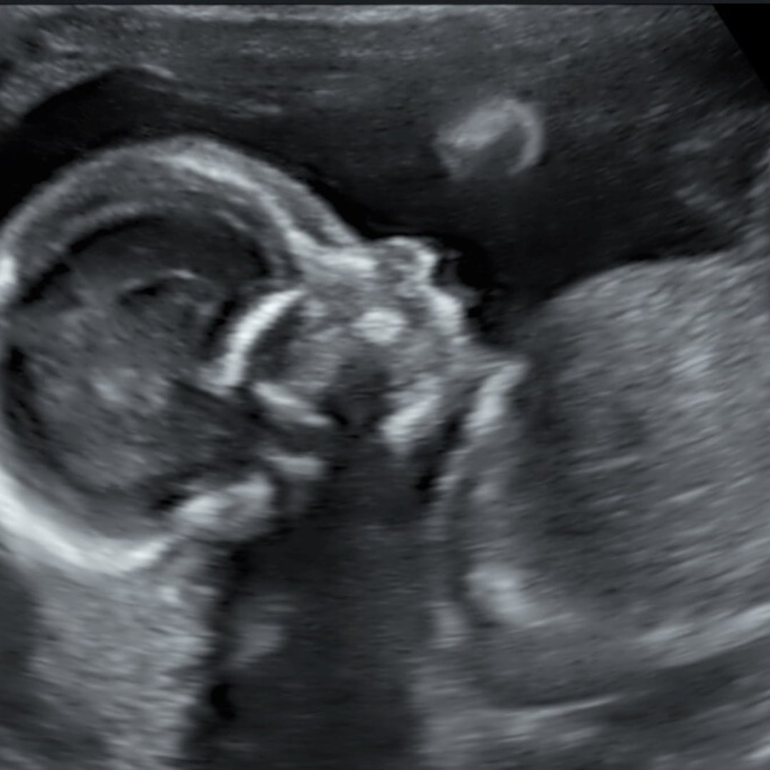 Photo shared by Jessie for their Babylist baby registry.