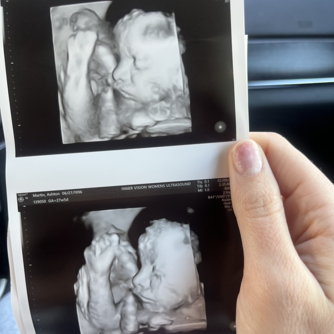 Photo shared by Ashton for their Babylist baby registry.