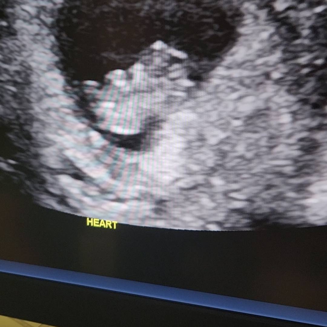 Photo shared by Laura for their Babylist baby registry.