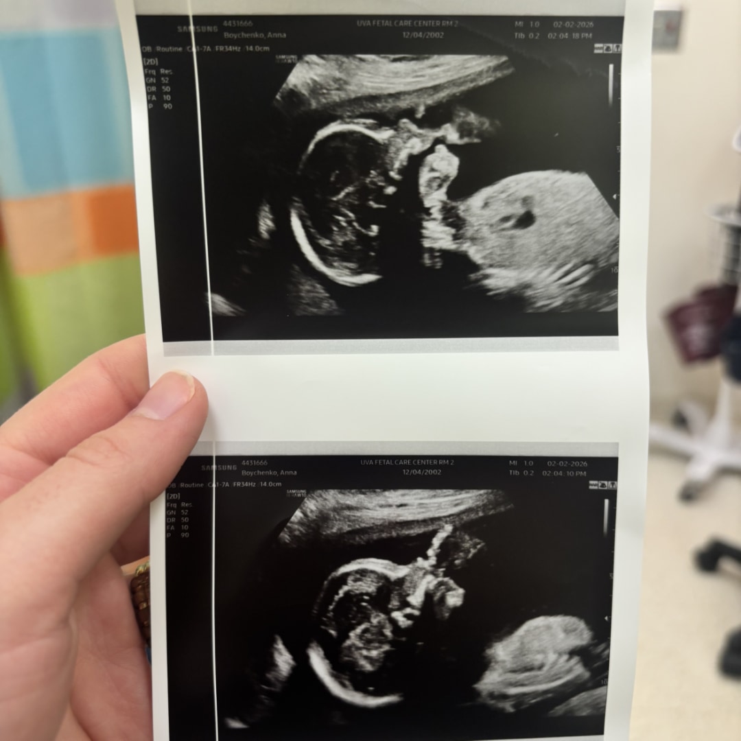 Photo shared by Anna for their Babylist baby registry.