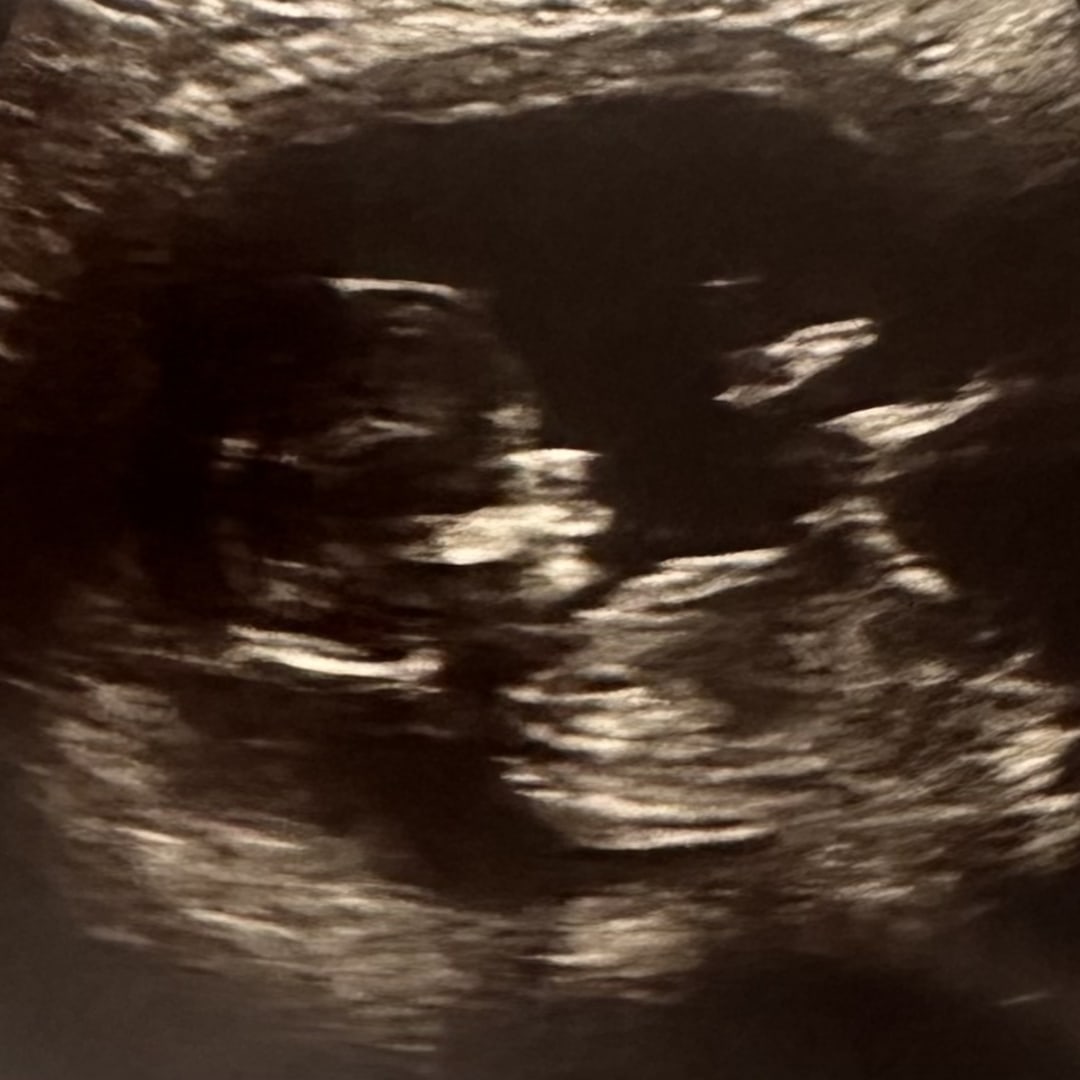 Photo shared by Alexis for their Babylist baby registry.