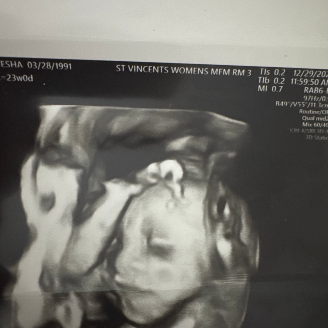 Photo shared by Lakiesha for their Babylist baby registry.